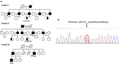 TTR Gly83Arg Mutation: Beyond Familial Vitreous Amyloidosis